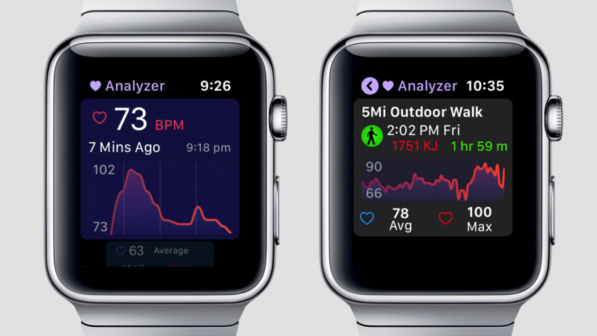 Heart Analyzer